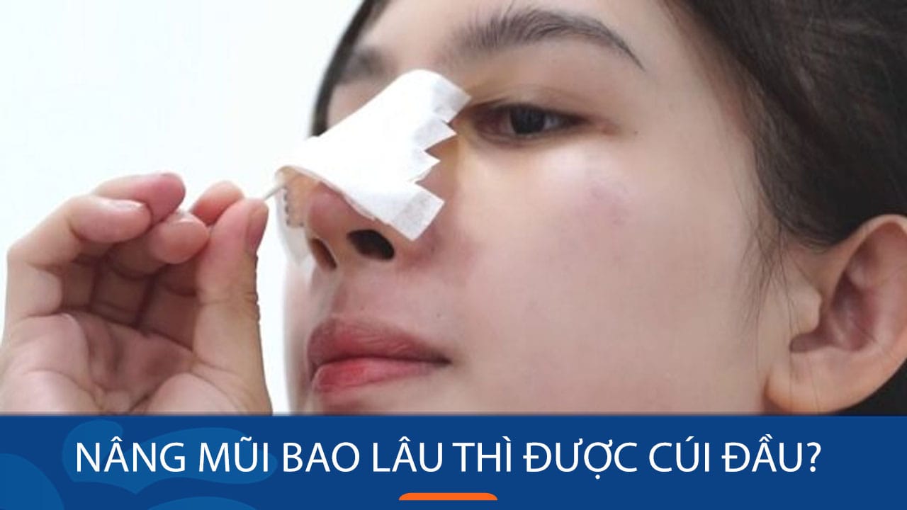 Nâng mũi bao lâu thì được cúi đầu?