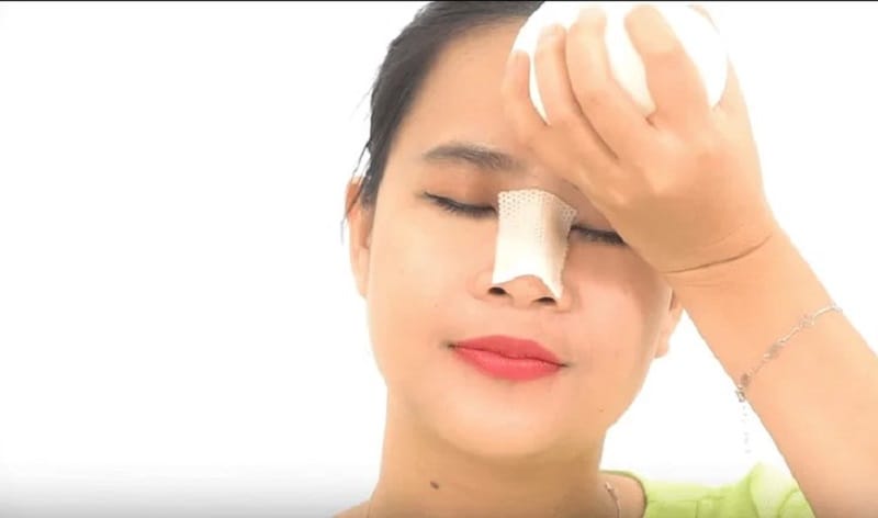 Chườm lạnh cho vết thương sau nâng mũi để giảm sưng tấy