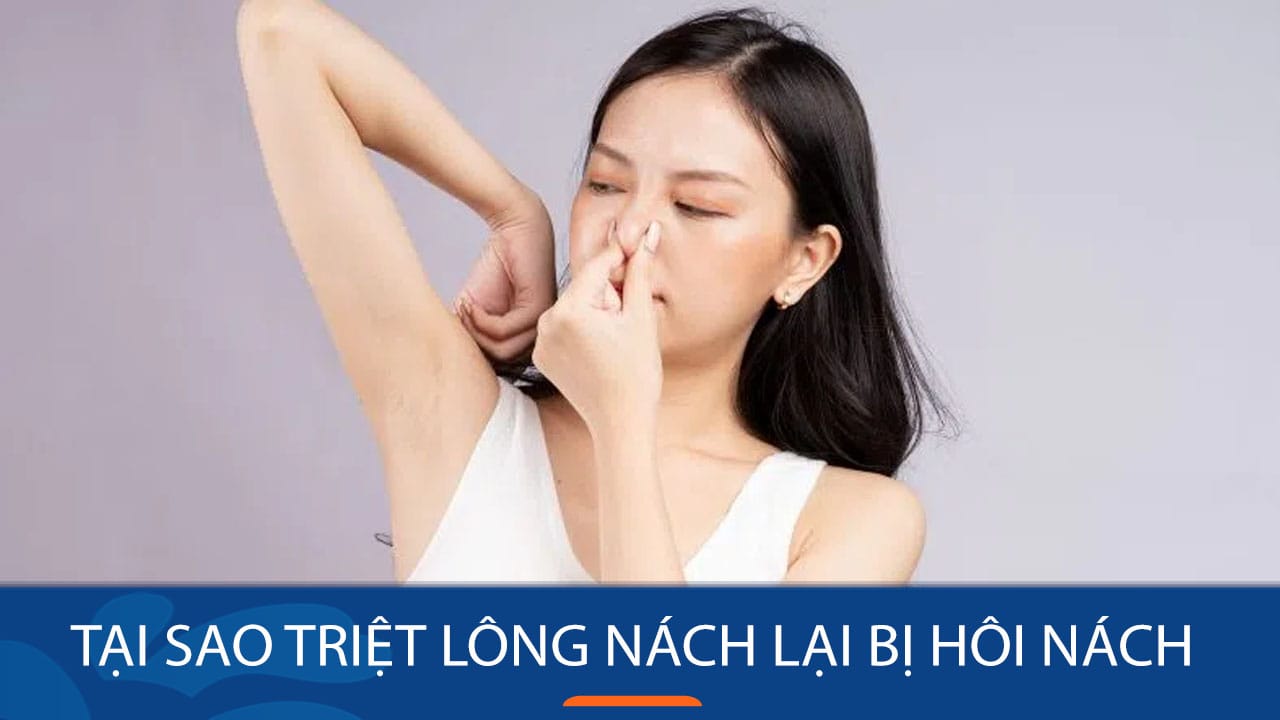 Tại sao triệt lông nách lại bị hôi nách? Một số sai lầm cần tránh