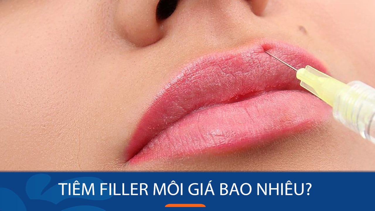 Tiêm filler môi giá bao nhiêu? Có thật sự “đắt xắt ra miếng”