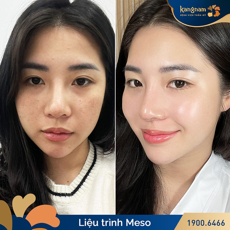 Sở hữu làn da ẩm mượt, căng bóng