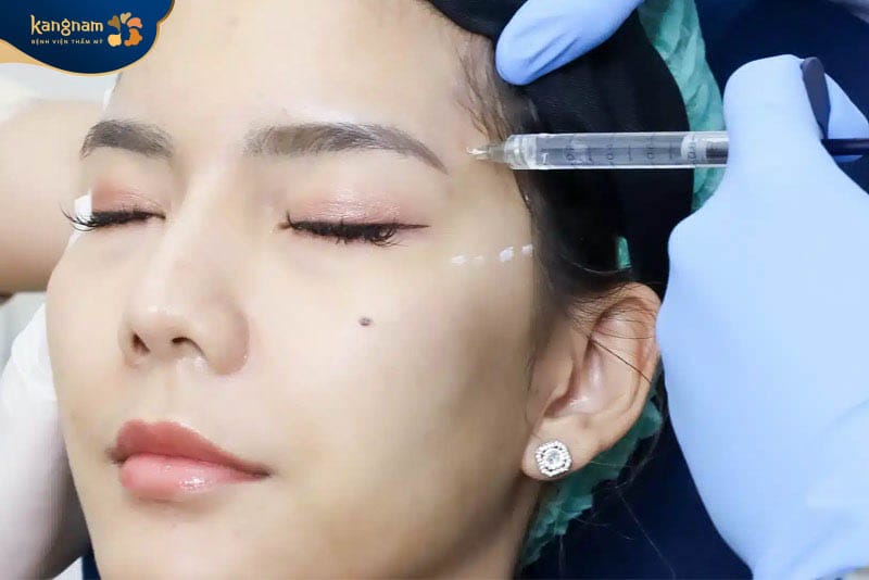 Chi phí tiêm tan filler ảnh hưởng của yếu tố lượng chất làm đầy cần tiêm