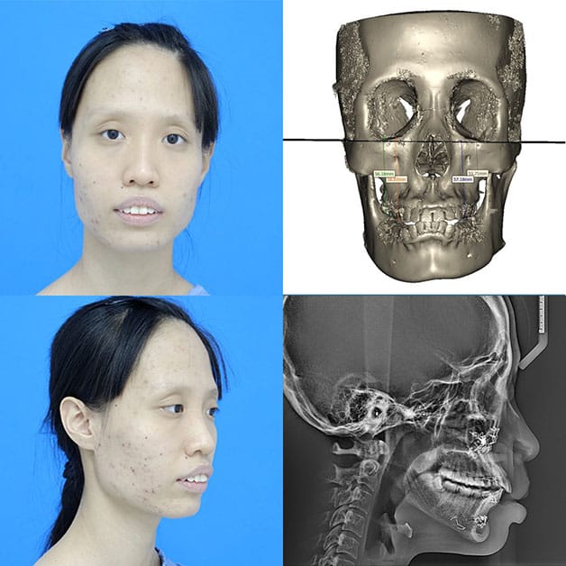 Cơ sở thẩm mỹ ứng dụng máy móc hiện đại có mức giá cao hơn