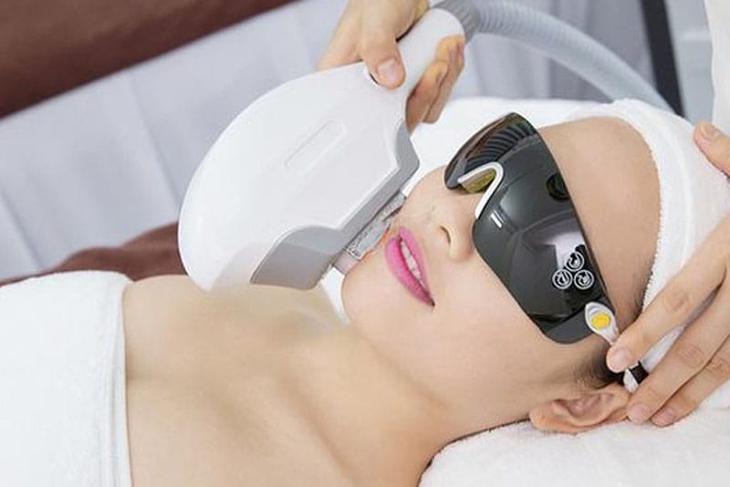 Công nghệ triệt lông hiện đại sẽ có chi phí cao hơn