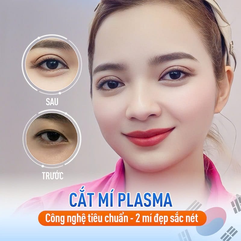 Công nghệ hiện đại sẽ giúp khách hàng sở hữu 2 mí sắc nét và cân đối