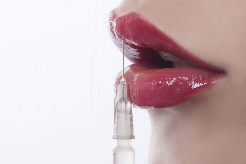 Bác sĩ sẽ tiêm dung dịch để làm tan filler