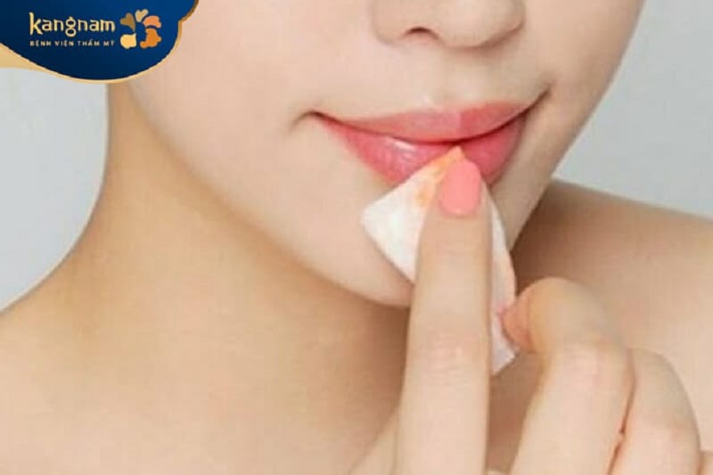 Vệ sinh môi sau tiêm filler sạch sẽ
