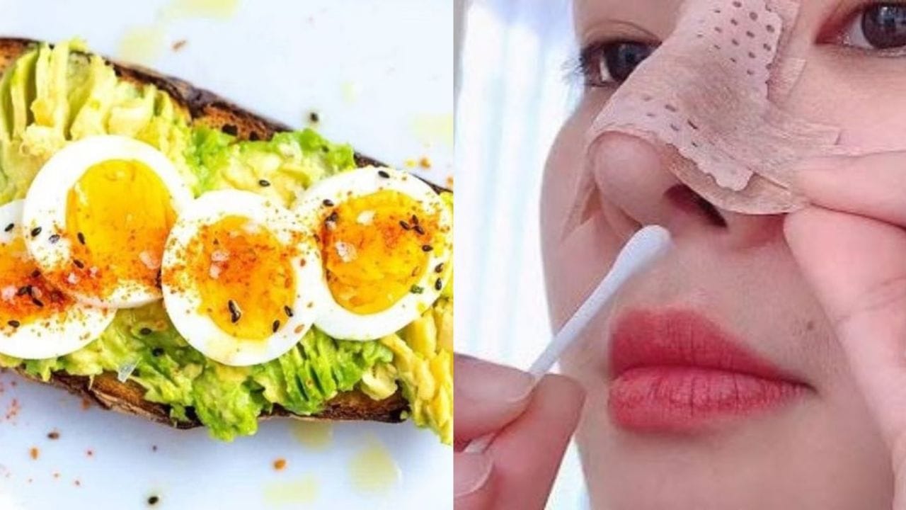 Nâng mũi ăn trứng được không? Kiêng bao lâu