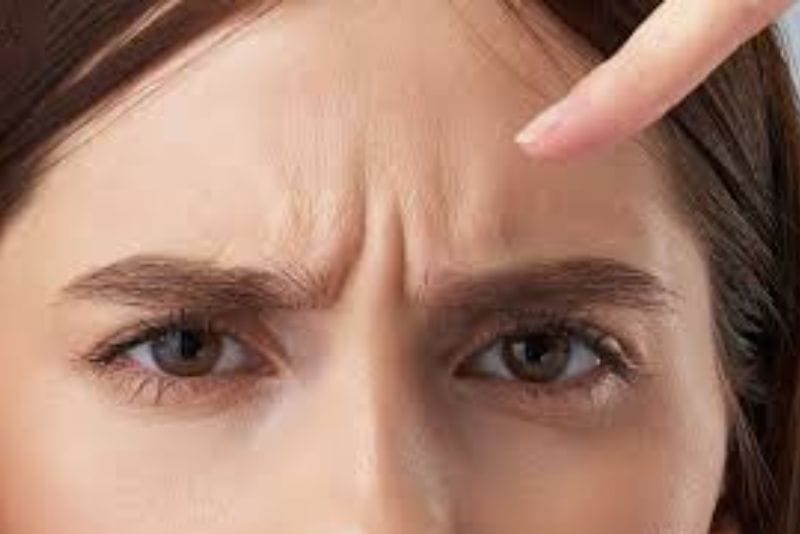 Nếp nhăn cau mày xuất hiện chủ yếu do lão hóa hoặc sự co thắt lặp đi lặp lại của cơ cau mày khi biểu lộ cảm xúc tức giận, lo lắng hoặc tập trung