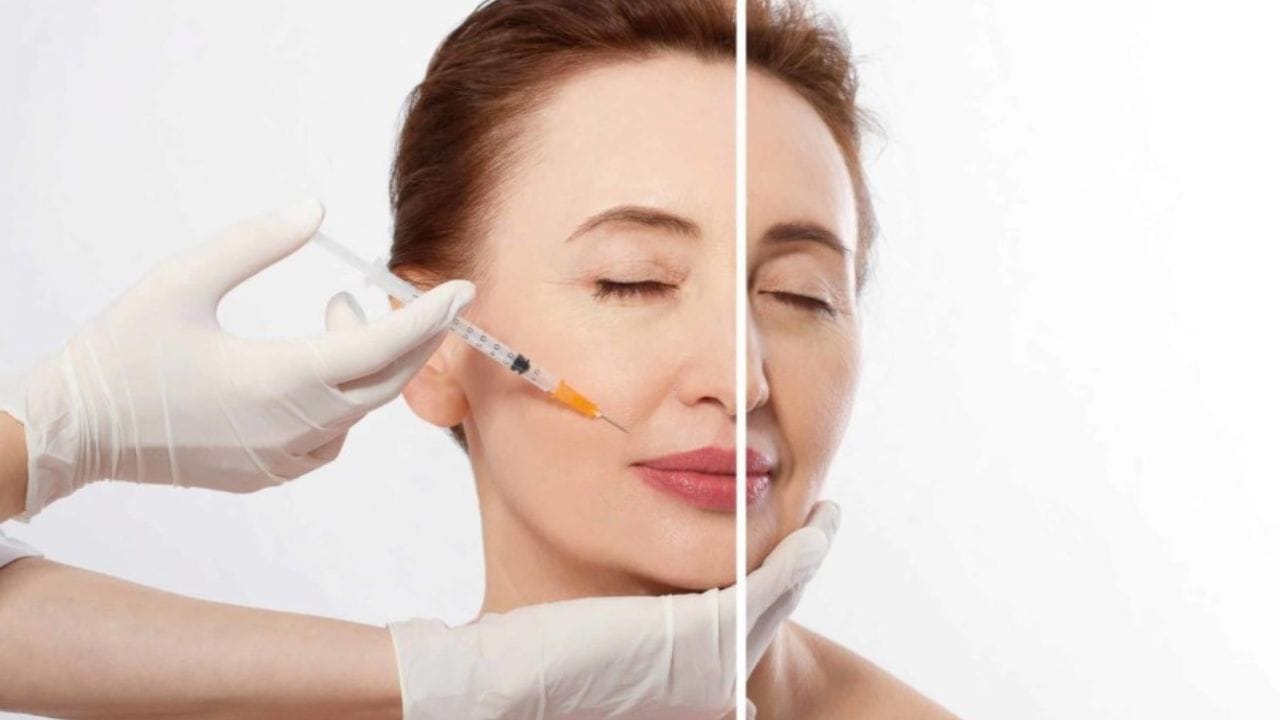 Tiêm filler có tốt không? Cảnh báo rủi ro và cách làm đẹp an toàn