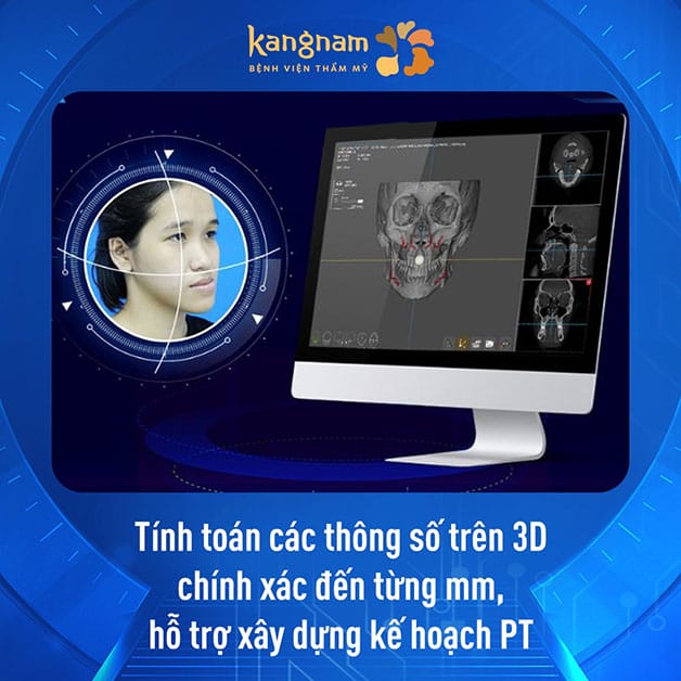 ứng dụng công nghệ mô phỏng 3D Face Design