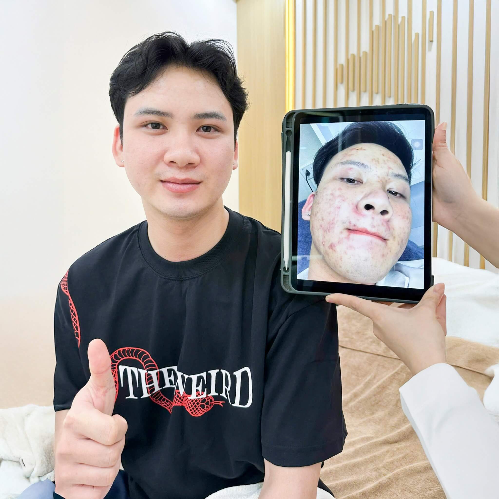 Sau liệu trình laser, sẹo thâm bắt đầu mờ rõ rệt sau 1-2 tuần