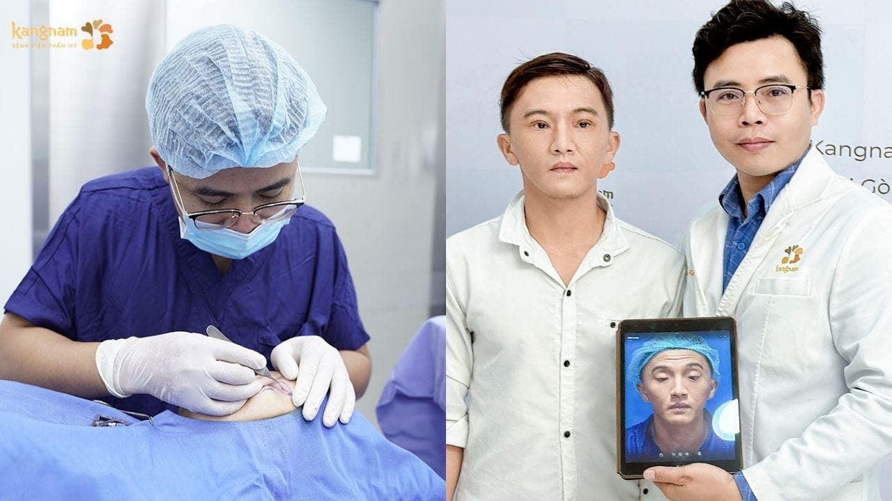 Bác sĩ nào cắt mí mắt đẹp tại TPHCM? Top 4 bác sĩ cắt mí nổi tiếng