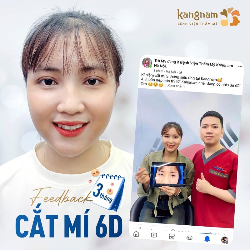 Kangnam có chuyên khoa cắt mí, ứng dụng đa dạng các công nghệ