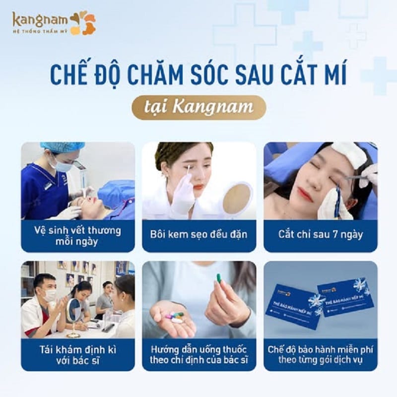Cắt mí tại Kangnam được hưởng chính sách và chế độ chăm sóc chu đáo