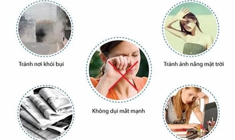 Kiêng cữ đúng cách sau cắt mí