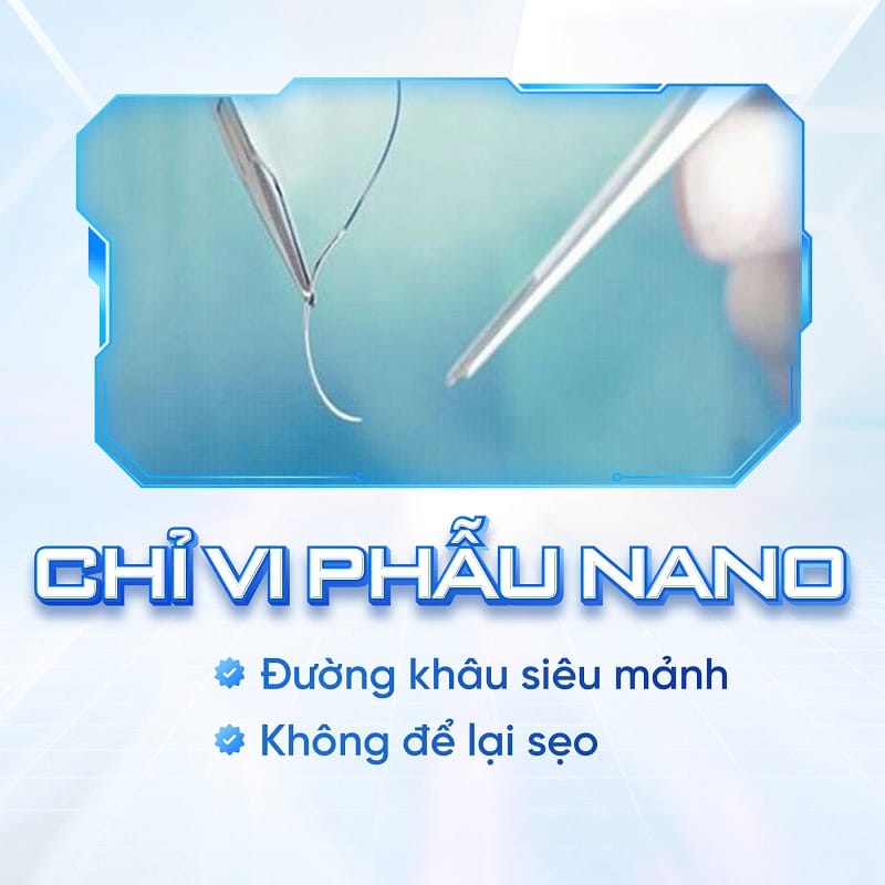 Cơ sở dùng chỉ khâu chất lượng cao sẽ không để lại sẹo