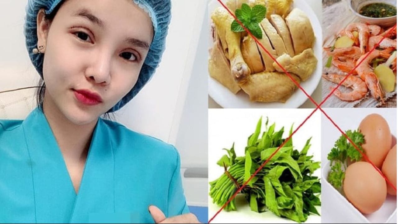 Cắt mí kiêng gì? Những nhóm thực phẩm cần kiêng