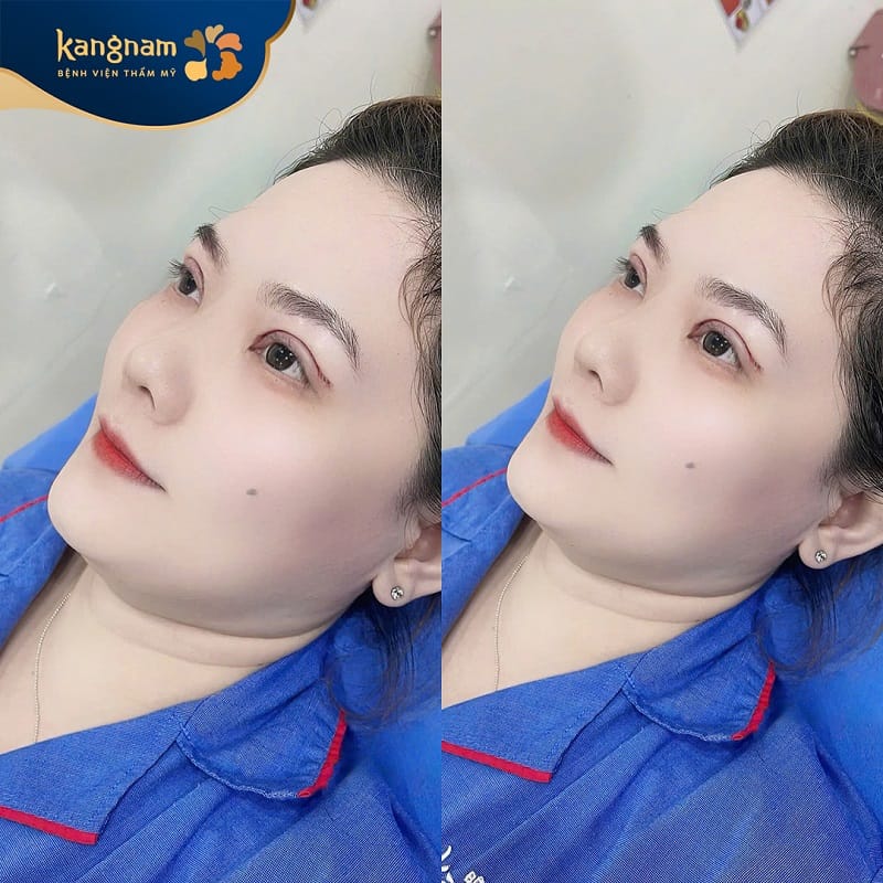 Vết thương nhanh lành, phục hồi nhanh chóng