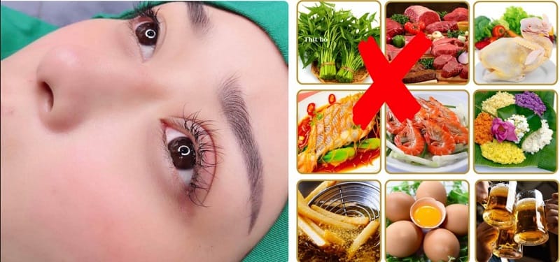 Nên tránh ăn các thực phẩm gây mưng mủ, kích ứng vết thương