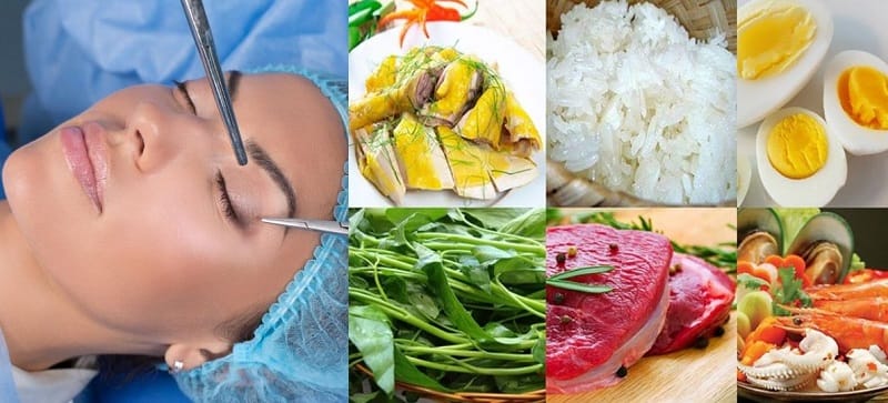 Cần tránh ăn rau muống, trứng, thịt bò, hải sản sau cắt mí