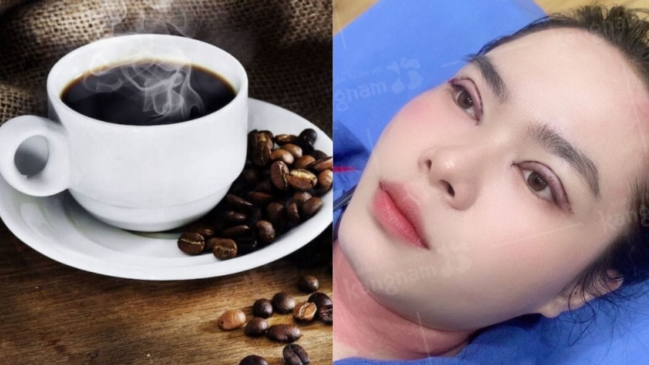 Cắt mí có uống cà phê được không? cần lưu ý điều gì