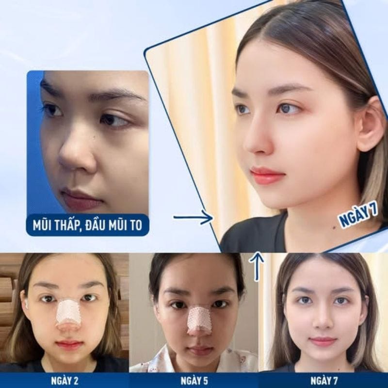 Quá trình hồi phục nhanh chóng