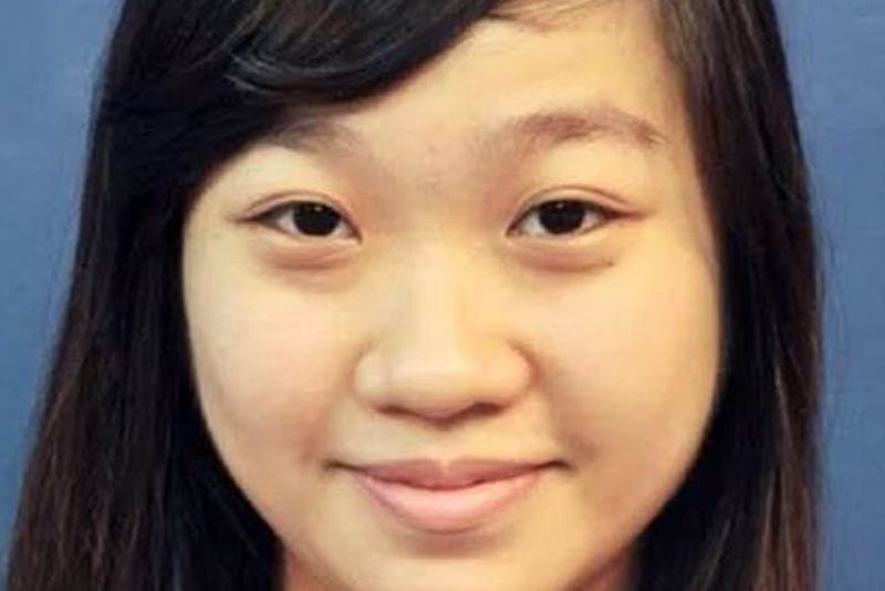 Nâng mũi bán cấu trúc phù hợp với người có một số khuyết điểm nhẹ ở mũi