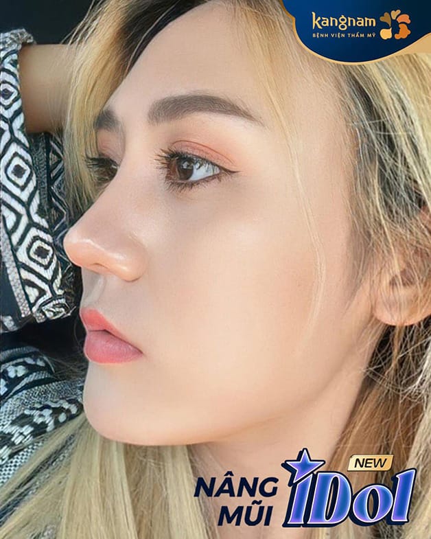 Khách hàng sở hữu dáng mũi đẹp