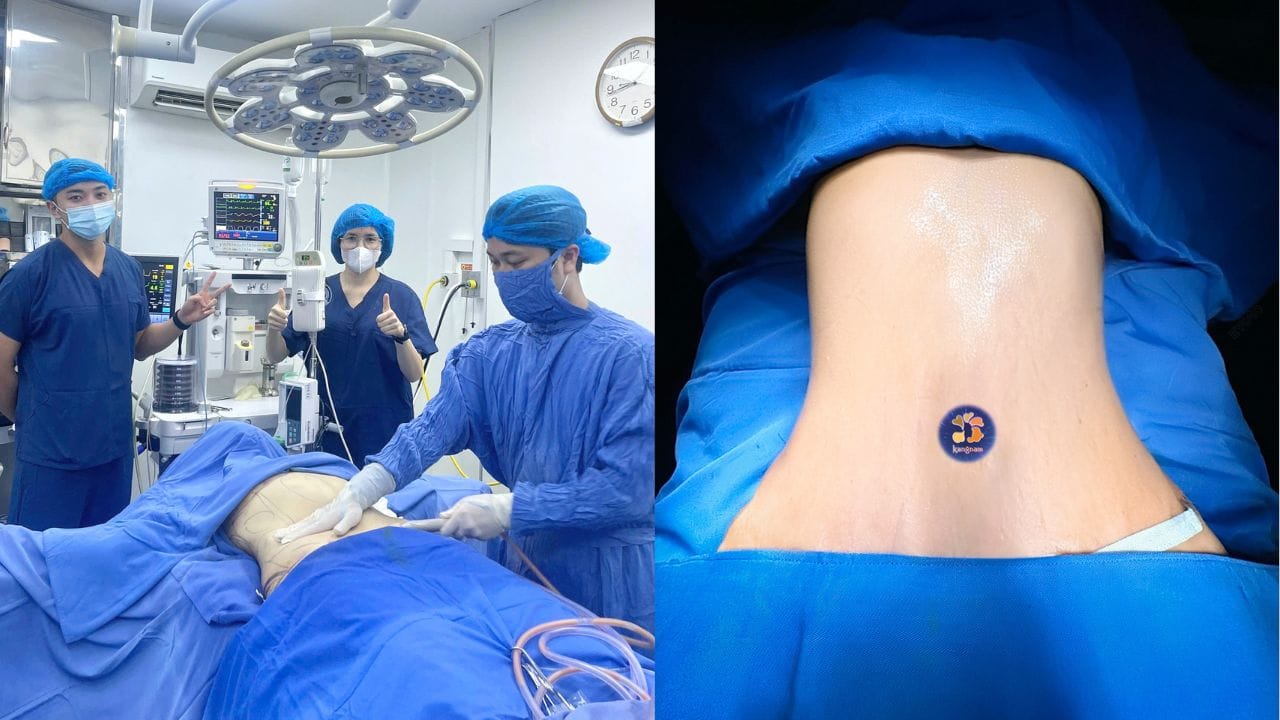 Gợi ý top 4 bác sĩ hút mỡ bụng giỏi và uy tin