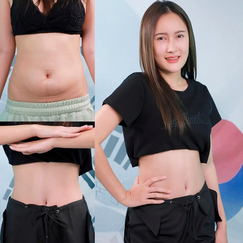 Khách hàng cảm thấy hài lòng với vóc dáng mới