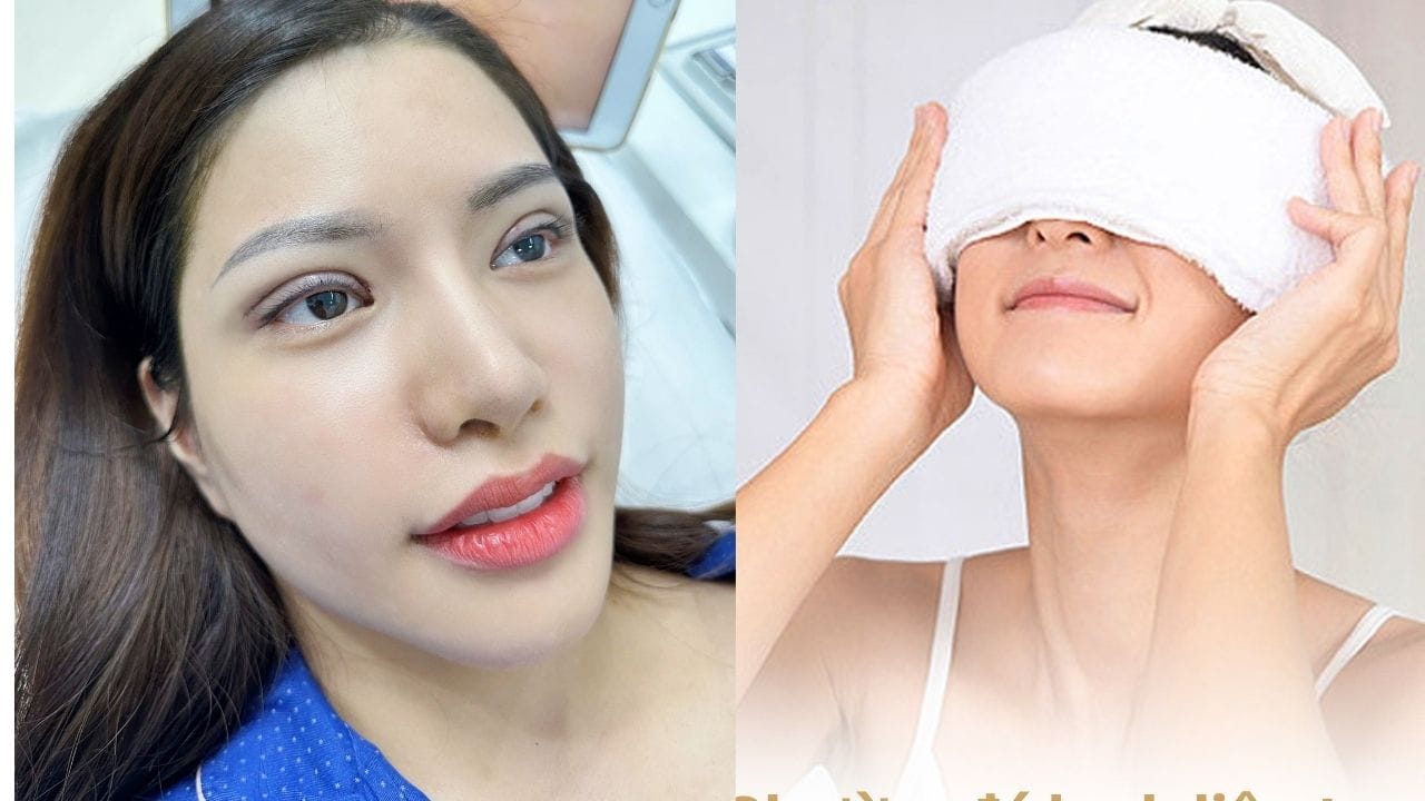 Hướng dẫn các cách giảm sưng sau khi cắt mí