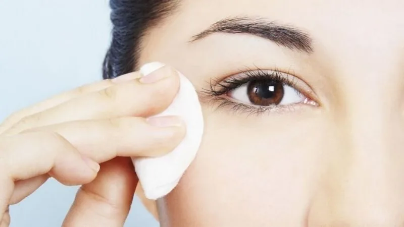 Clean your eyelids before having the stitches removed. 
