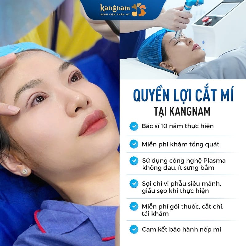 Kangnam có các công nghệ cắt mí hiện đại, giúp duy trì nếp mí lâu dài