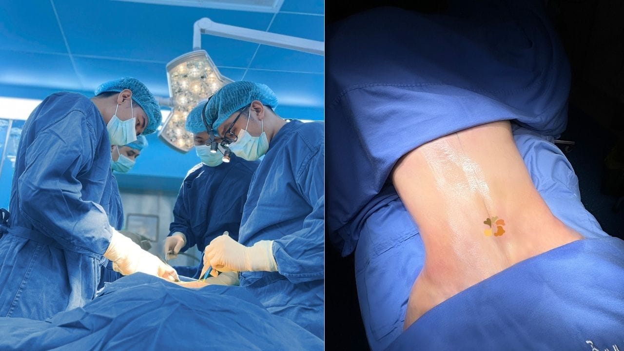 Hút mỡ bụng ở bệnh viện nào tốt? Gợi ý top 5 địa chỉ hút mỡ bụng an toàn