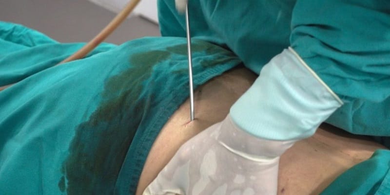 Khách hàng có thể gặp nhiều biến chứng nguy hiểm