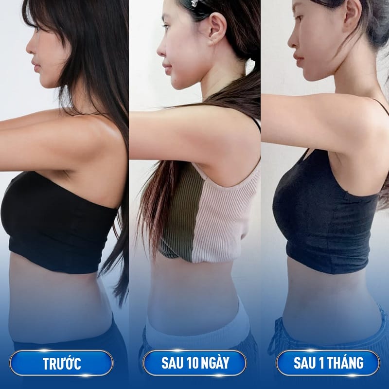 Lấy lại vòng eo con kiến an toàn và hiệu quả