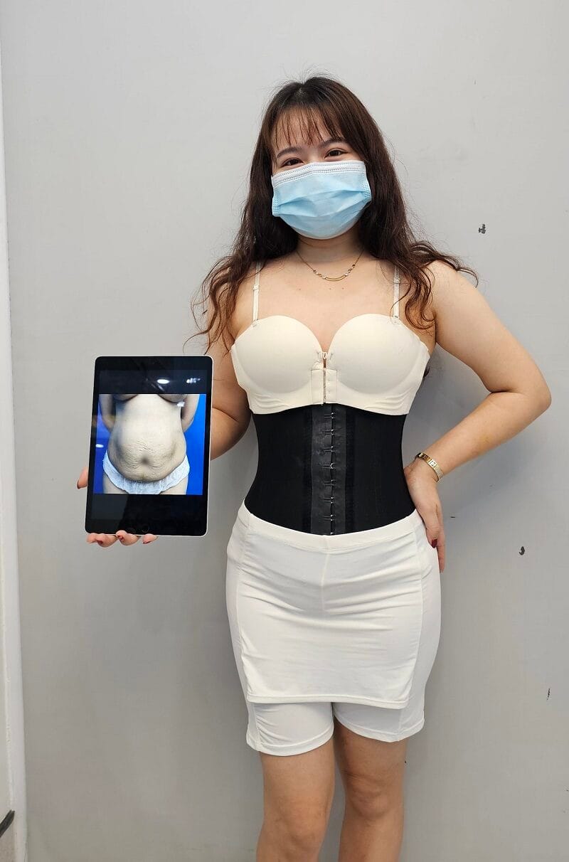 Khách hàng cần đeo đai định hình để giúp vòng eo săn chắc, vào form