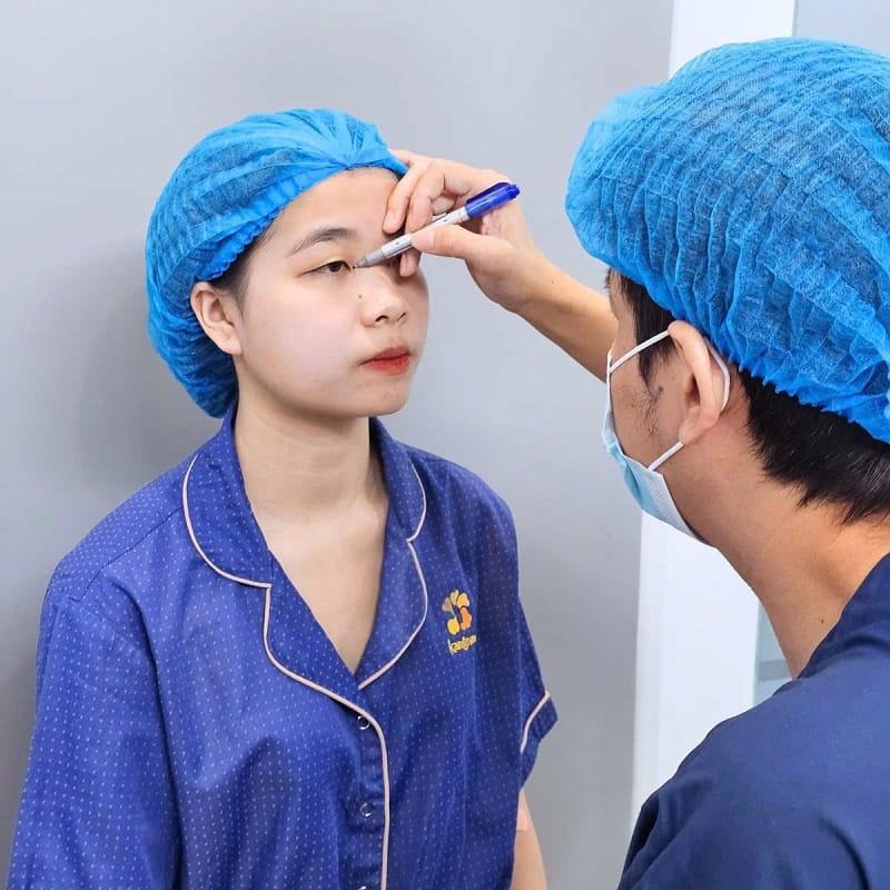 Kangnam có bác sĩ chuyên khoa trực tiếp nhấn mí cho khách hàng