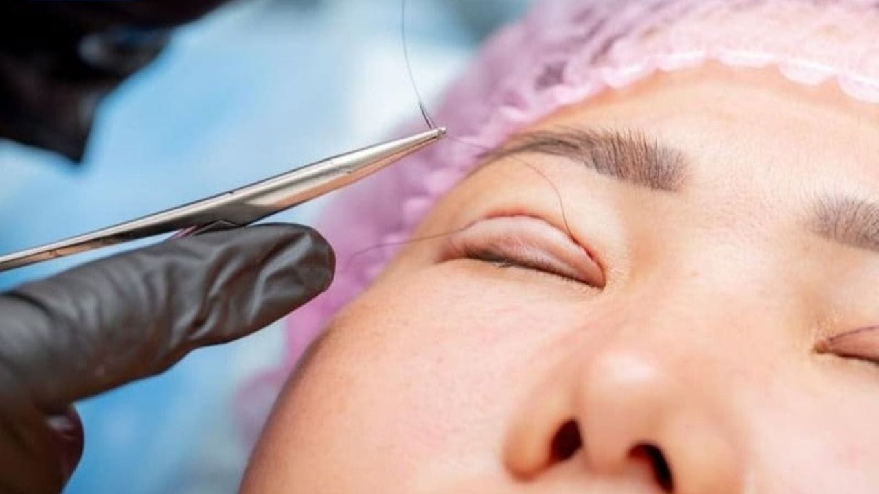 Nhấn mí có đau không? Một số lưu ý trước khi thực hiện