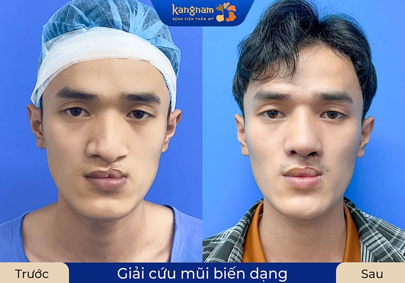 Anh Hải (32 tuổi, Việt kiều Úc)