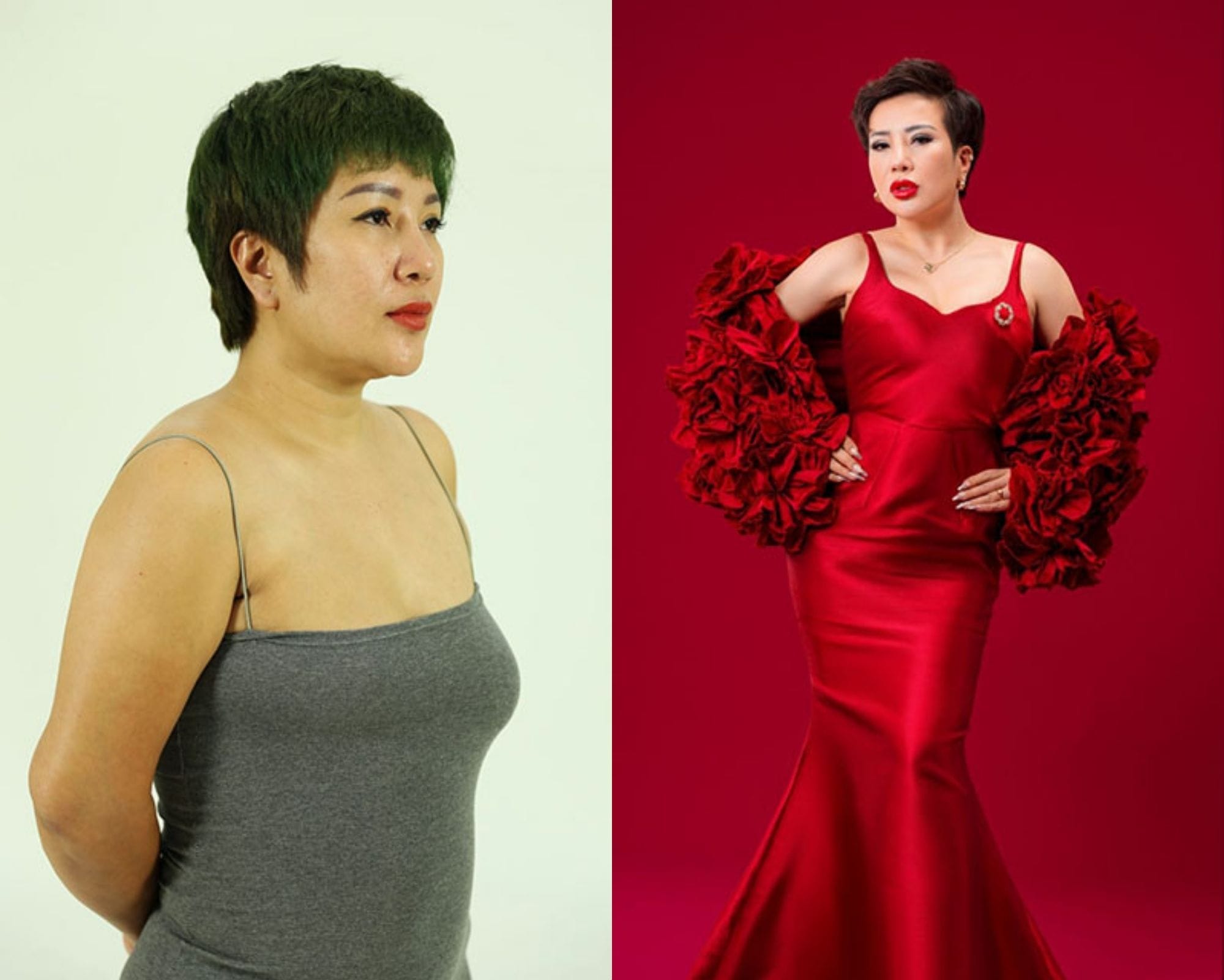 Nâng ngực không ảnh hưởng đến tuổi thọ