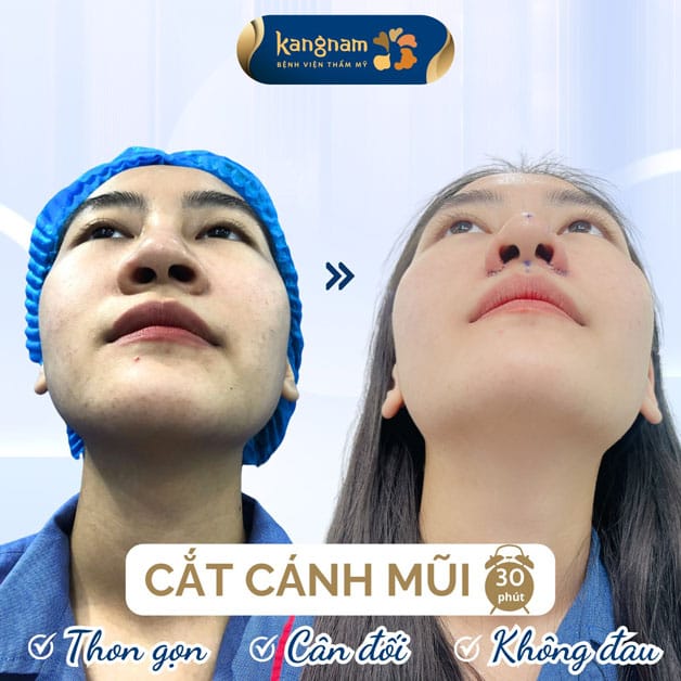 Dáng mũi tự nhiên, cân đối