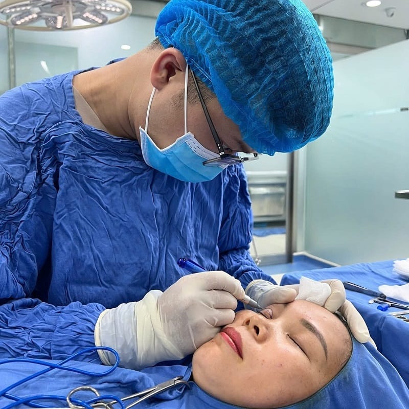 Kỹ thuật cắt mí cũ, lỗi thời có thể để lại sẹo cho khách hàng