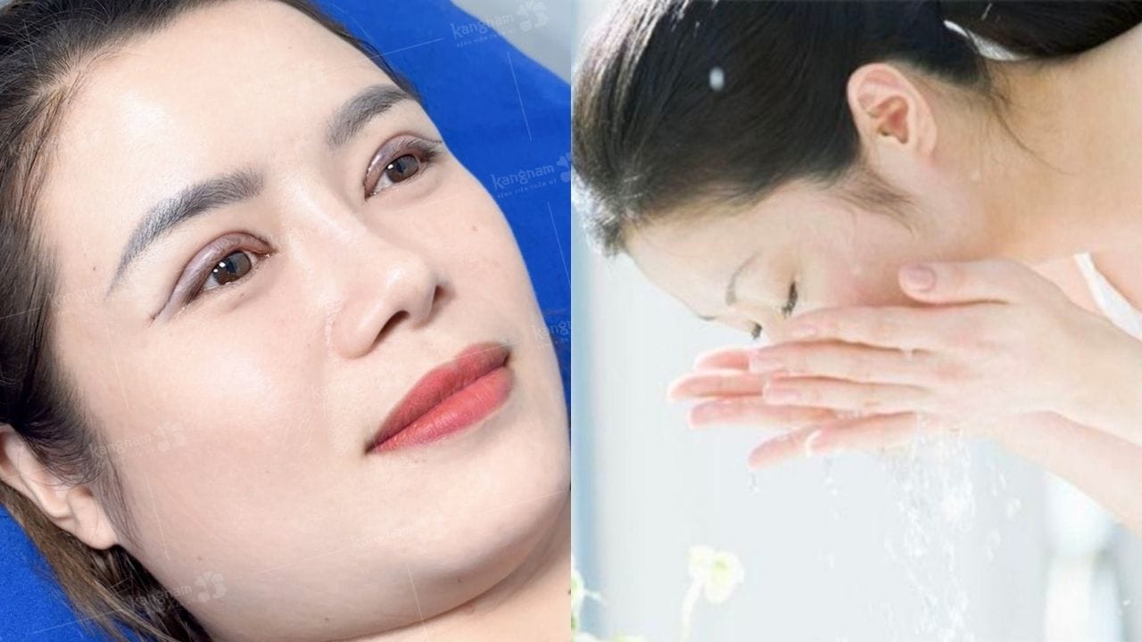 Cắt mí mắt sau bao lâu thì rửa mặt được? Những điều cần lưu ý