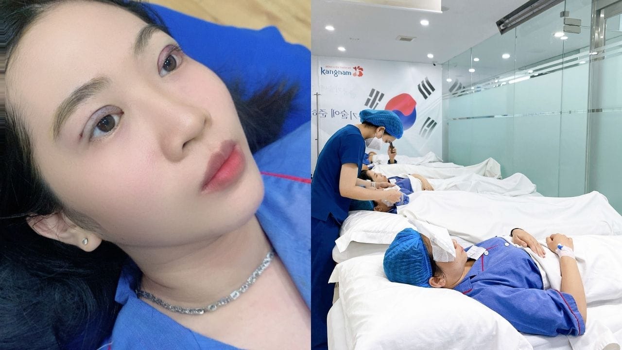 Cắt mí mắt có cần phải nằm viện không? Trường hợp nào cần phải nằm viện