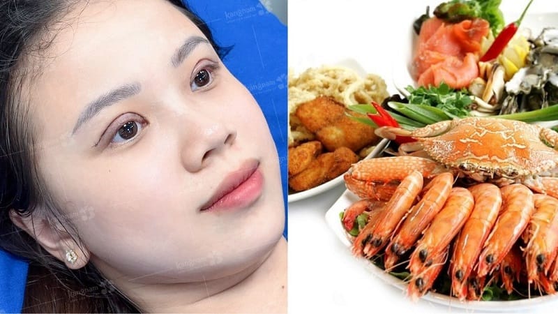 Nên kiêng cữ đến khi nếp mí phục hồi ổn định