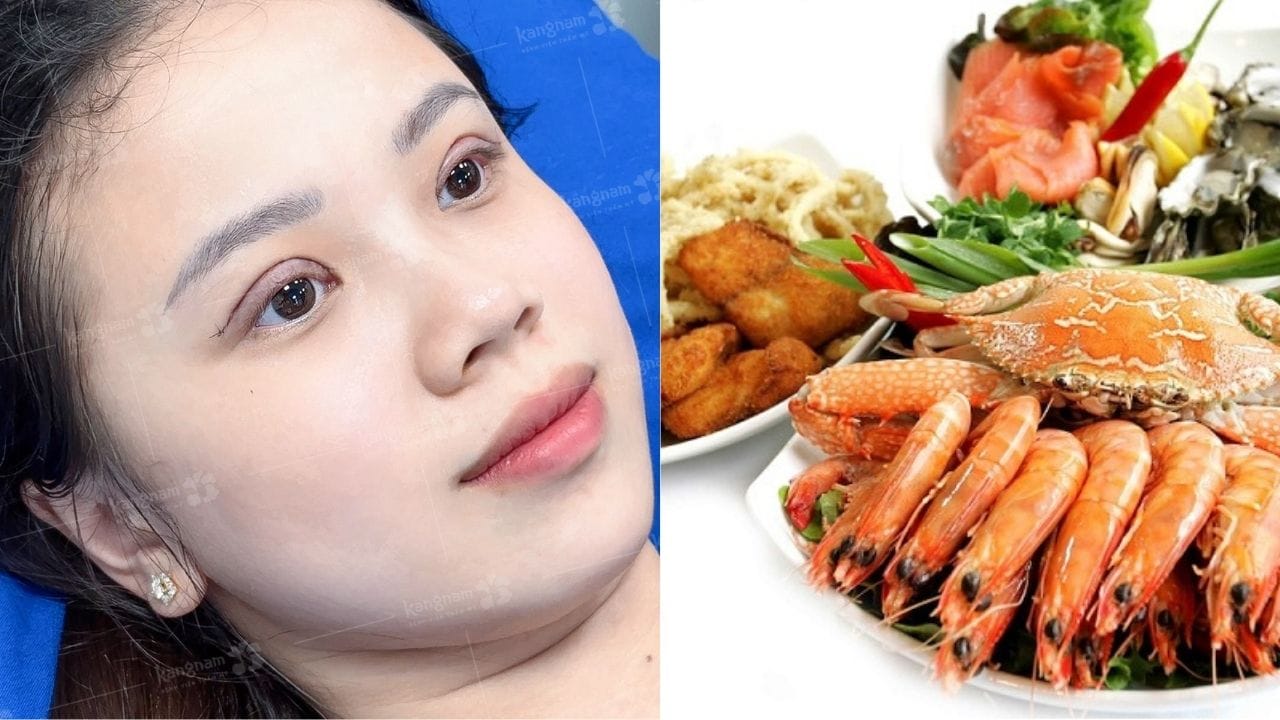 Cắt mí mắt nên kiêng ăn gì? Tổng hợp những thực phẩm cần kiêng