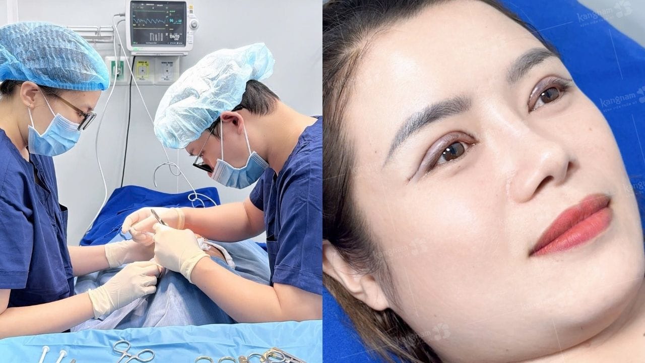 Cắt mí mắt ở đâu đẹp tại Hà Nội? Top 5 địa chỉ cắt mí chất lượng cao