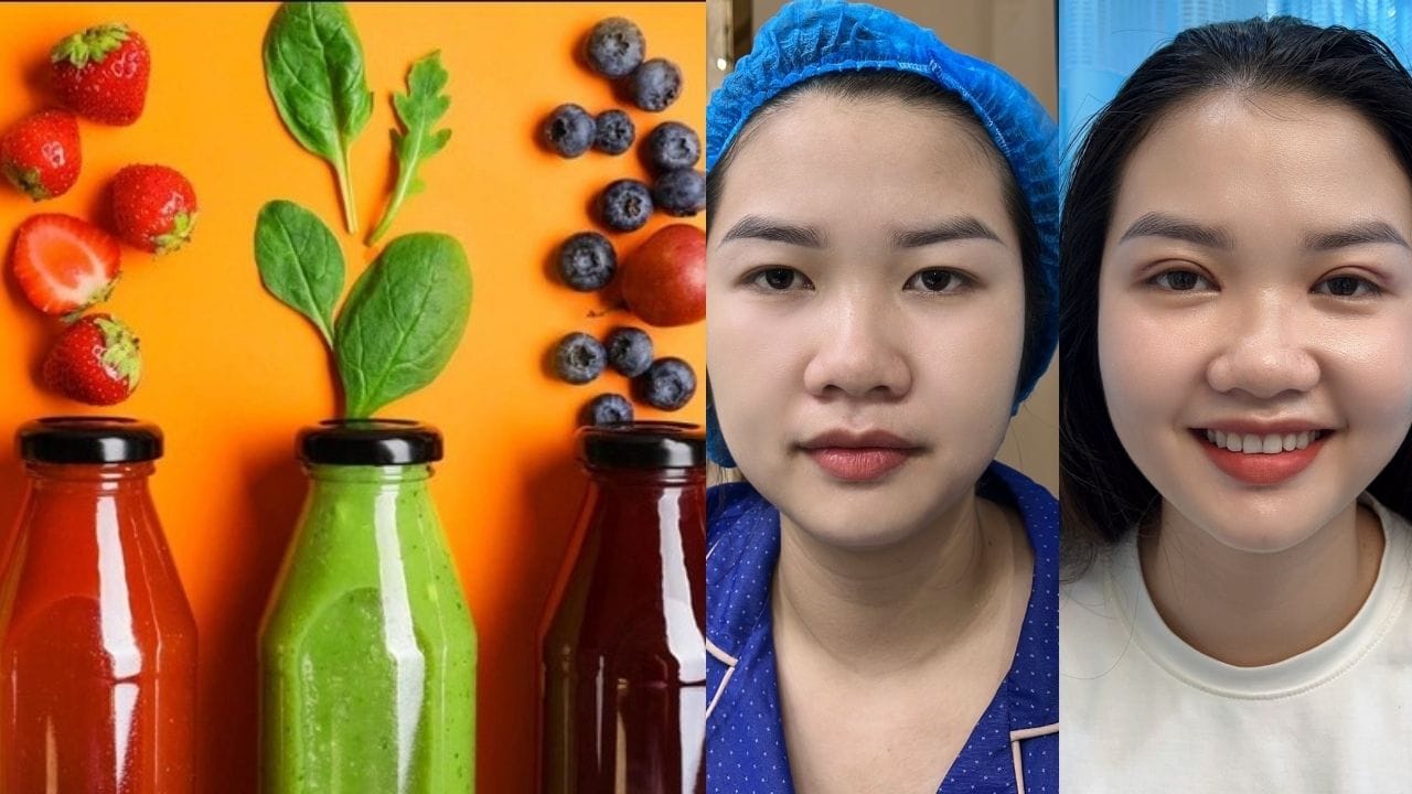 Cắt mí xong nên uống gì để nhanh lành? Gợi ý các thức uống sau cắt mí